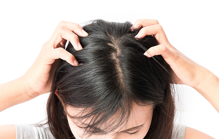 头部瘙痒的症状和原因？头部瘙痒怎么办？如何预防头部瘙痒？